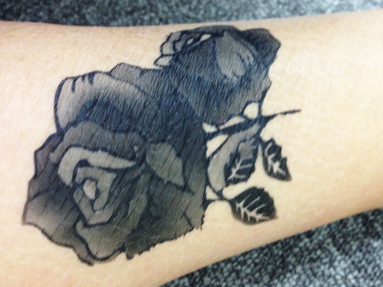 イレズミ・アートメイク除去｜六本木のクリアスキンクリニック西麻布